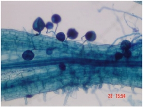 This microscopic image reveals an example of a mycorrhiza in a mesquite tree. Mycorrhiza is a mutually beneficial association between plant roots and a fungus, seen here as ball, and thread-like structures in which each partner makes nutrients available that the other can't produce on its own. (Photo credit: F. Solis-Dominguez) This microscopic image reveals an example of a mycorrhiza in a mesquite tree. Mycorrhiza is a mutually beneficial association between plant roots and a fungus, seen here as ball, and thread-like structures in which each partner makes nutrients available that the other can't produce on its own. (Photo credit: F. Solis-Dominguez)